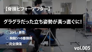 【脊損ビフォーアフター】胸髄5〜6番 - グラグラだった立ち姿勢が真っ直ぐに！