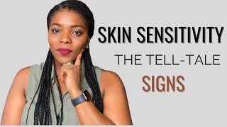 7 Signs of SENSITIVE SKIN | Dr Janet
