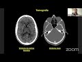 repaso de neuroanatomÍa repaso integrador de anatomía