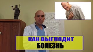 12. Уроки остеопатии 12 # Как выглядит Ваша болезнь или что такое дисфункция в теле