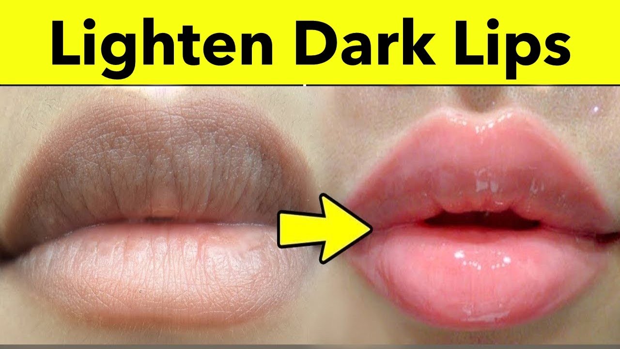 How To Lighten Dark Lips Naturally - 4 Rapid Home Remedies | Dark Lips ...