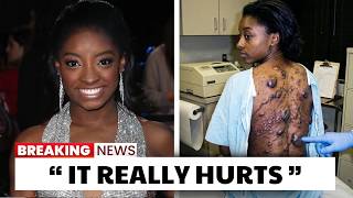 25 Black Celebrities Who Are Fighting The Worst Deadly Diseases As Of 2026