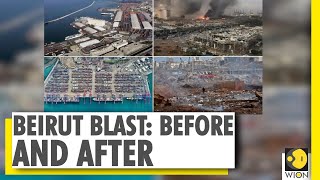 Lebanon Blast Aftermath | Protesters take to the streets of Beirut | World News