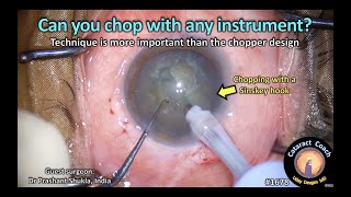 CataractCoach™ 1678: can you chop with any instrument?