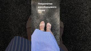 Невропатия #малоберцового нерва - невозможно стать на пятку и поднять пальцы. #виситстопа