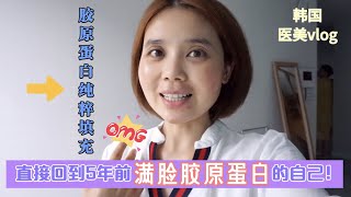 强大的韩国医美！直接回到了5年前满满胶原蛋白的自己的样子！胶原蛋白纯粹填充实录vlog