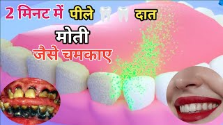 सिर्फ 2 मिनट में पीले गंदे दांतो को मोती जैसे चमका देगा ये जादुई घरेलू नुस्खा/Teeth Whitening remedy