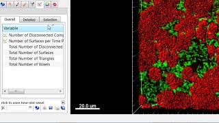 Analysing biofilms in Imaris - Tutorial