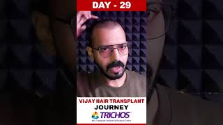 #AskDrJohnWatts | DAY - 29 of VIJAY’S HAIR TRANSPLANT JOURNEY | #besthairtransplant #drjohnwatts