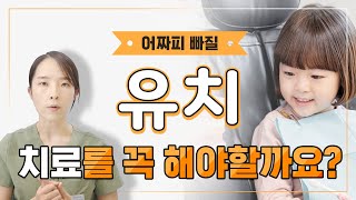 유치 👧어짜피 빠질텐데 치료해야 하나요🤔?? 치료가 꼭 필요한 경우와 치료하지 않을 경우 영구치에 미치는 영향까지 알려드립니다!✔✔#유치#유치치료#유치충치#유치신경치료