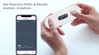 Wellue Handheld EKG MONITOR WITH OLED SCREEN