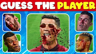 ⚽ YOU witnessed the WORST INJURIES in Football History!😱🩸Who Got INJURY? | Ronaldo, Messi