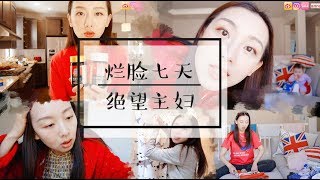 【vlog#12】采访老公关于全职主妇|烂脸七天|看皮肤科|我吃的保健品|闲聊关于我这个人|超长掉粉vlog