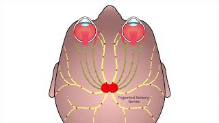 Neurologist on Neurolens