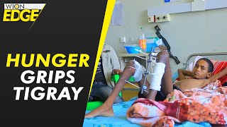 Malnourished children in hospital as hunger grips Tigray | WION Edge