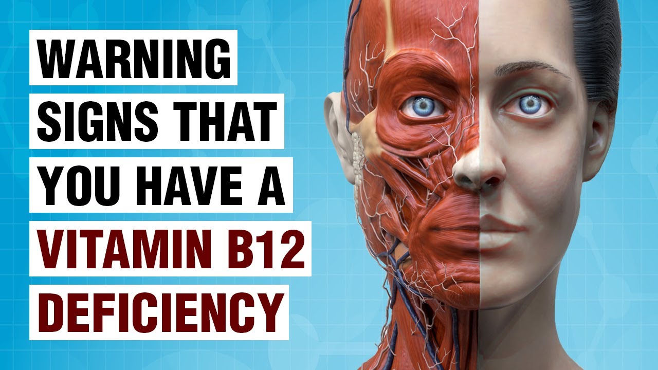 10 Symptoms Of Vitamin B12 Deficiency You Should Never Ignore - YouTube