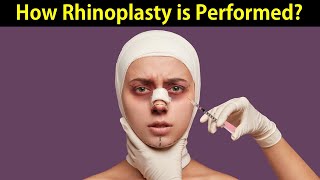 Rhinoplasty  (Nasal surgery) video animation اردو / हिन्दी