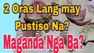 2 Oras lang may Pustiso kana, Madaliaang paggawa ng pustiso Maganda nga Ba?