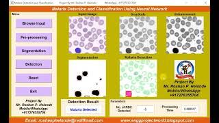 2023 Latest Top 10 Biomedical Projects With Source Code Top Biomedical Final Year Projects Codes