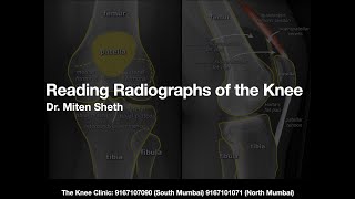 Reading Radiographs of the Knee