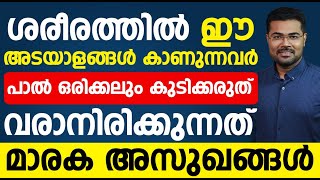 ശരീരത്തിൽ ഈ അടയാളങ്ങൾ കാണുന്നവർ സൂക്ഷിക്കുക പാൽ ഒരിക്കലും കുടിക്കരുത് |life style disease