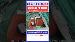 37歲高齡背疼了兩天，醫生只是看了一眼，差點就下了病危通知書 #启汉元桌派 #纪实 #醫療紀錄片 #生命緣 #醫院