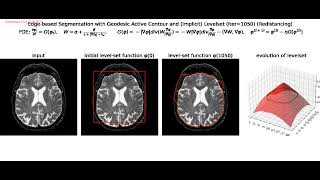 Edge-based Segmentation | Geodesic Active Contours | Snakes | Level Sets | Curvature Motion | python