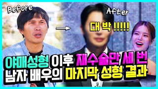 180도 변신😲 야매 성형 받은 후 재수술만 세 번 한 남배우의 마지막 페이스 오프 | MAKE미남