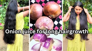 ONION JUICE FOR EXTREME HAIR GROWTH ||Stop hair fall and grow longhair faster||miki singh