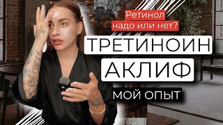 РЕТИНОЛ, ТРЕТИНОИН, АКЛИФ. МОЙ ОПЫТ 2 ГОДА ИСПОЛЬЗОВАНИЯ