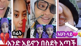 በስደት አንድ አይኖን አጣች ሞራ ለማስገፈፍ ሂዳ ሙሉ አይኖን አጣች😢