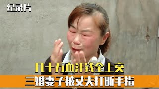 几十万血汗钱全上交，妻子转眼送娘家，丈夫竟打断妻子手指！纪实