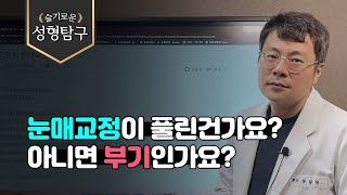 Q. 눈매교정이 풀린건가요? 아니면 부기인가요?