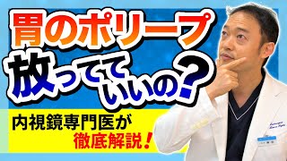 胃ポリープはほってていいのか　内視鏡専門医による解説