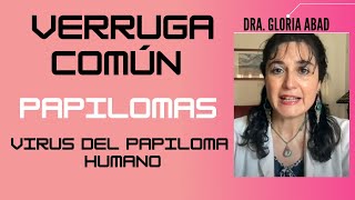 PAPILOMAS Y VERRUGA COMÚN O MEZQUINOS Virus del PAPILOMA Humano ¿Las VERRUGAS son cancerígenas? 😰