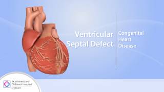 Heart Conditions – Ventricular Septal Defect (VSD)