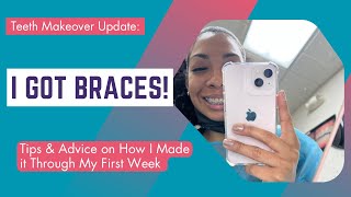 Adult Braces | First Step to My Smile Makeover- Tips & Advice to Surviving Week 1 in Braces