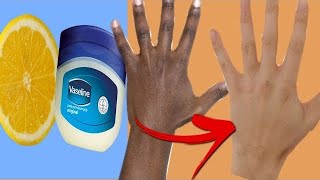 Skin Whitening BY ONLY Vaseline and LEMON !!! (Results In LIVE Video)