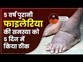 5 वर्ष पुरानी फाइलेरिया (Filariasis) की समस्या को 5 दिन में किया ठीक || Swami Ramdev