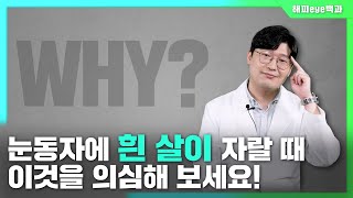 [해피 eye 백과] 눈에 흰 살이 자라난다고?!