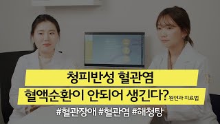 혈관염｜망상청피반(청피반성 혈관염) 혈액순환이 안되어 생긴다? 원인과 치료법 Henoch-Schonlein Purpura