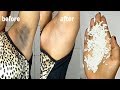IN 5 MINUTE REMOVE DARK UNDER ARMS USING RICE 100% WORKING IN 5 MINUTE REMOVE DARK UNDER ARMS USING RICE 100% WORKING