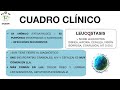 86 100 leucemia linfoblÁstica aguda. enarm