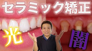 【セラミック矯正】は危険？歯科医師がセラミック矯正のメリットとデメリット、治療の流れを解説