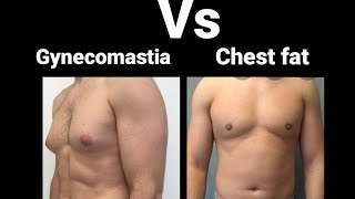 How to lose chest fat //difference of gynecomastia and chest fat explained.#chest #fitness #workout