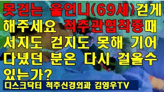 한달간 못걸은 울언니 걸을수 있을까요? 비수술척추치료  디스크닥터 신경외과 김영우 척추관협착증 척추디스크탈출증 양방향척추내시경 현미경척추수술 허리아플때 요통 목통증 목디스크 팔통증