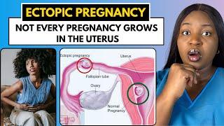 What Is An Ectopic Pregnancy? | Symptoms Of Ectopic Pregnancy You Should NEVER Ignore