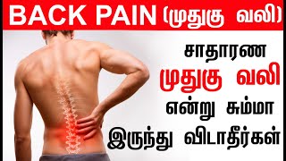 முதுகு வலி என்று சும்மா இருந்து விடாதீர்கள்| Lower Back Pain Treatment | Back Pain Relief in Tamil