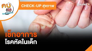 เช็กอาการโรคหัดในเด็ก : CHECK-UP สุขภาพ (31 ม.ค. 65)