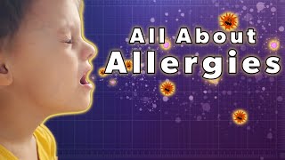 What are Allergies? I Parentalogic